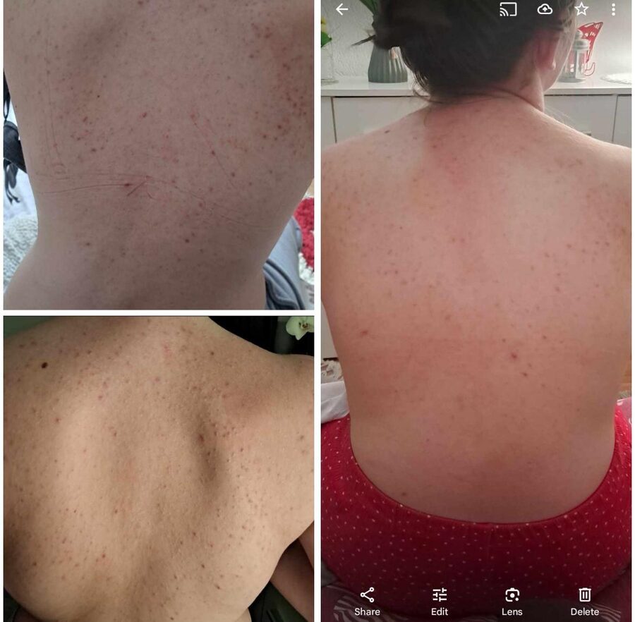 Prije i poslije korištenja Dr Aid seta