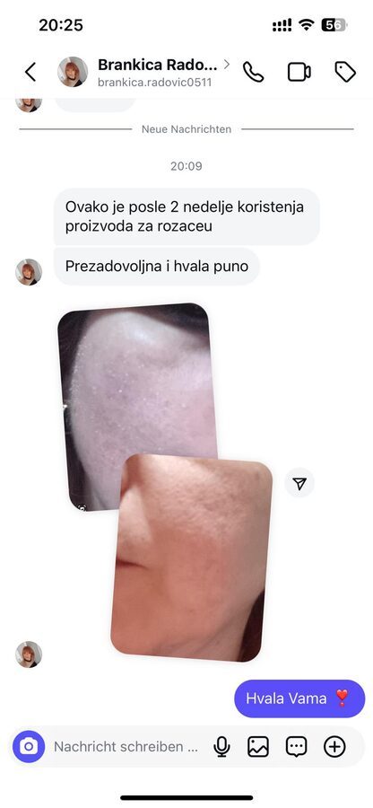 Iskustvo zadovoljne klijentice