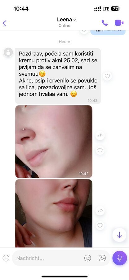 Iskustvo zadovoljne klijentice
