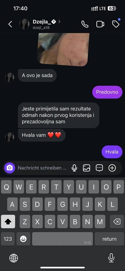 Iskustvo zadovoljne klijentice