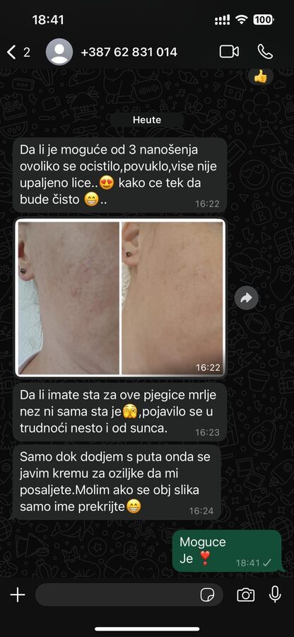 Iskustvo zadovoljne klijentice